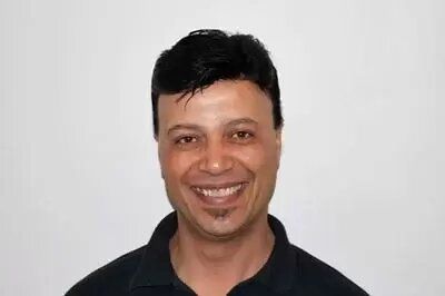 After - mens hair replacement system front view
