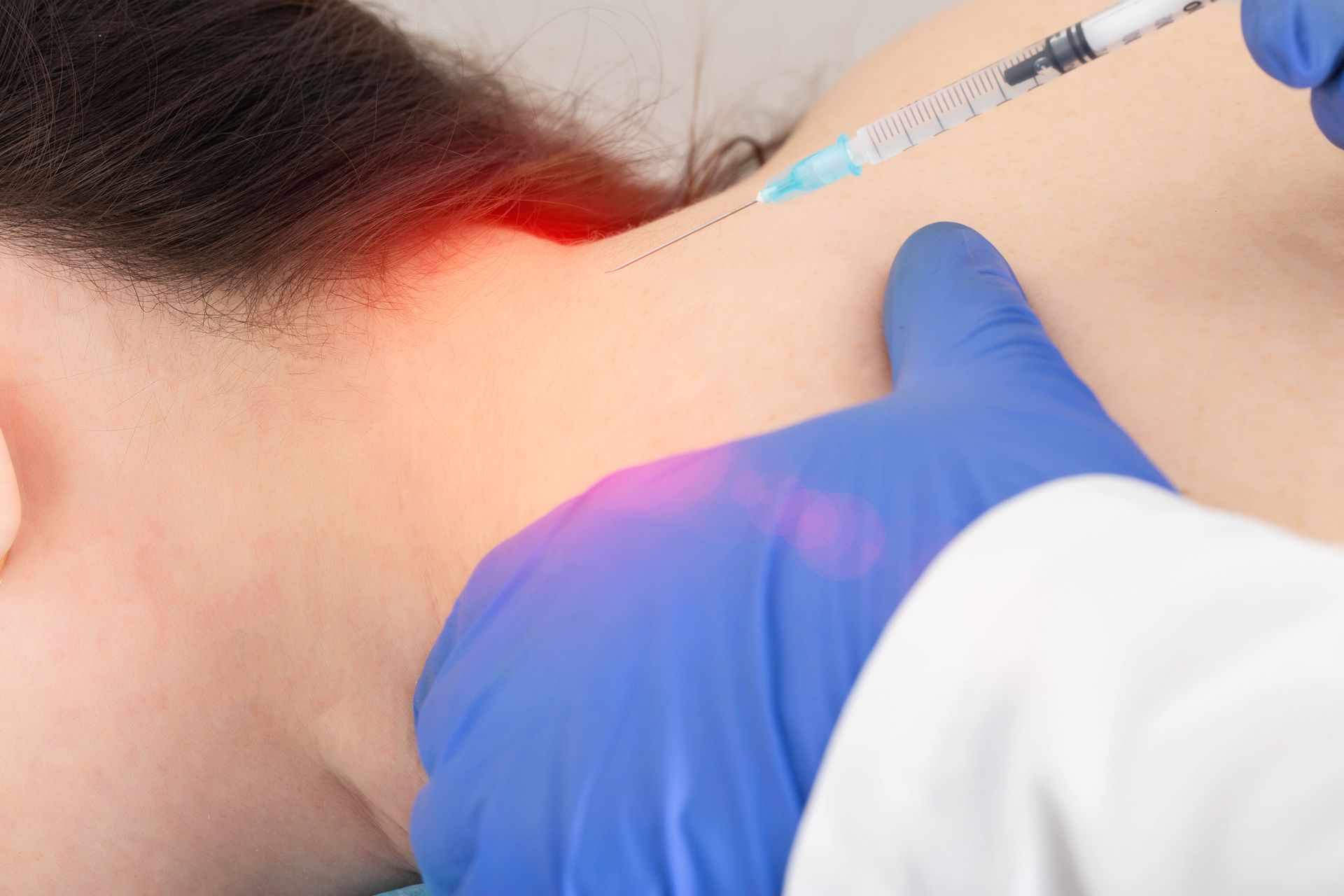 Occipital Injections