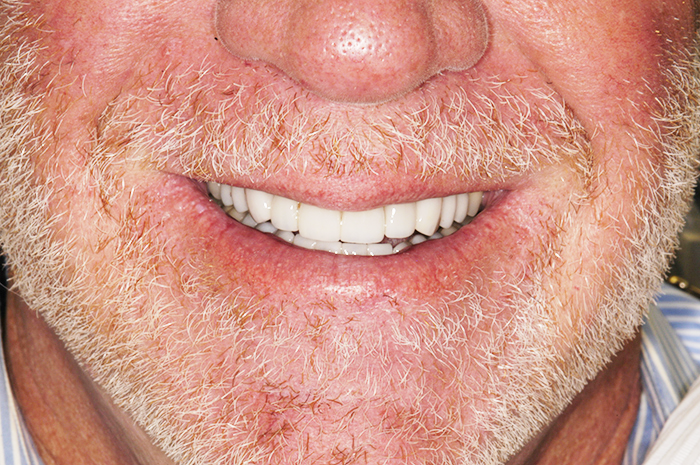 A man with a beard and white teeth is smiling.