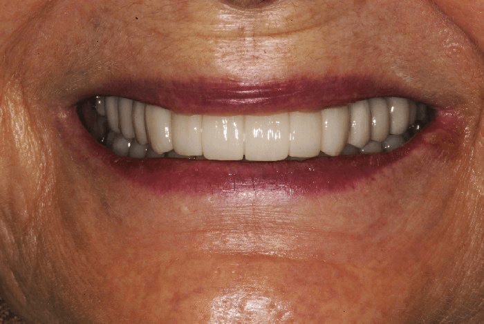 A close up of a woman 's smile with white teeth and red lips.