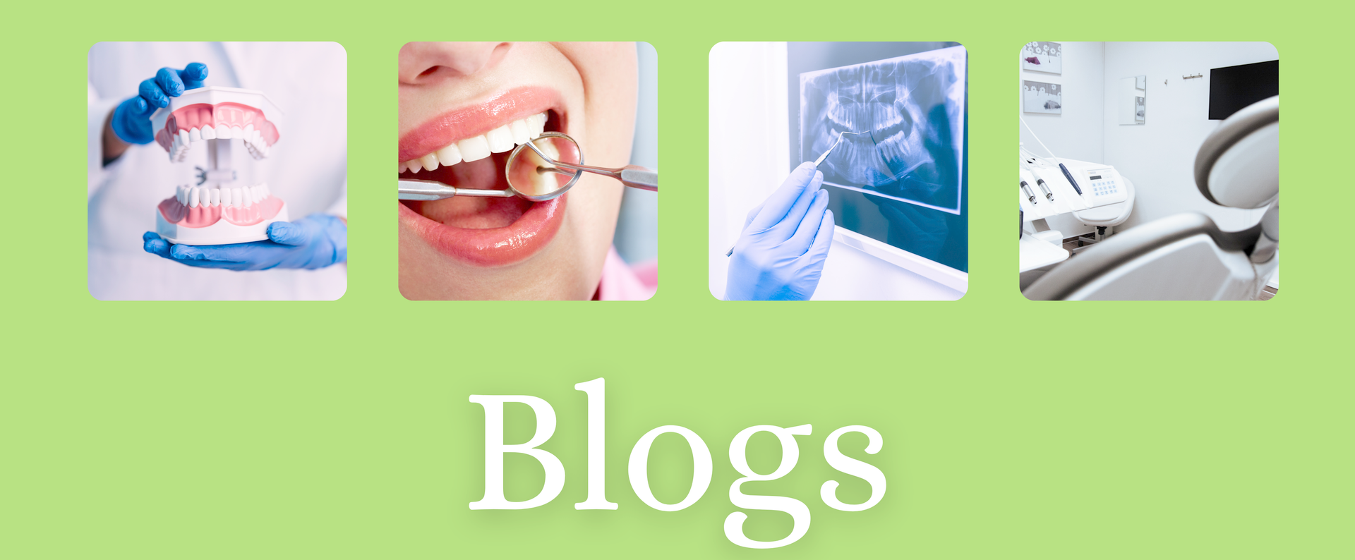 Dental blogs banner with four square images: dentist holding a model, patient's mouth, dental X-ray, and dental chair.