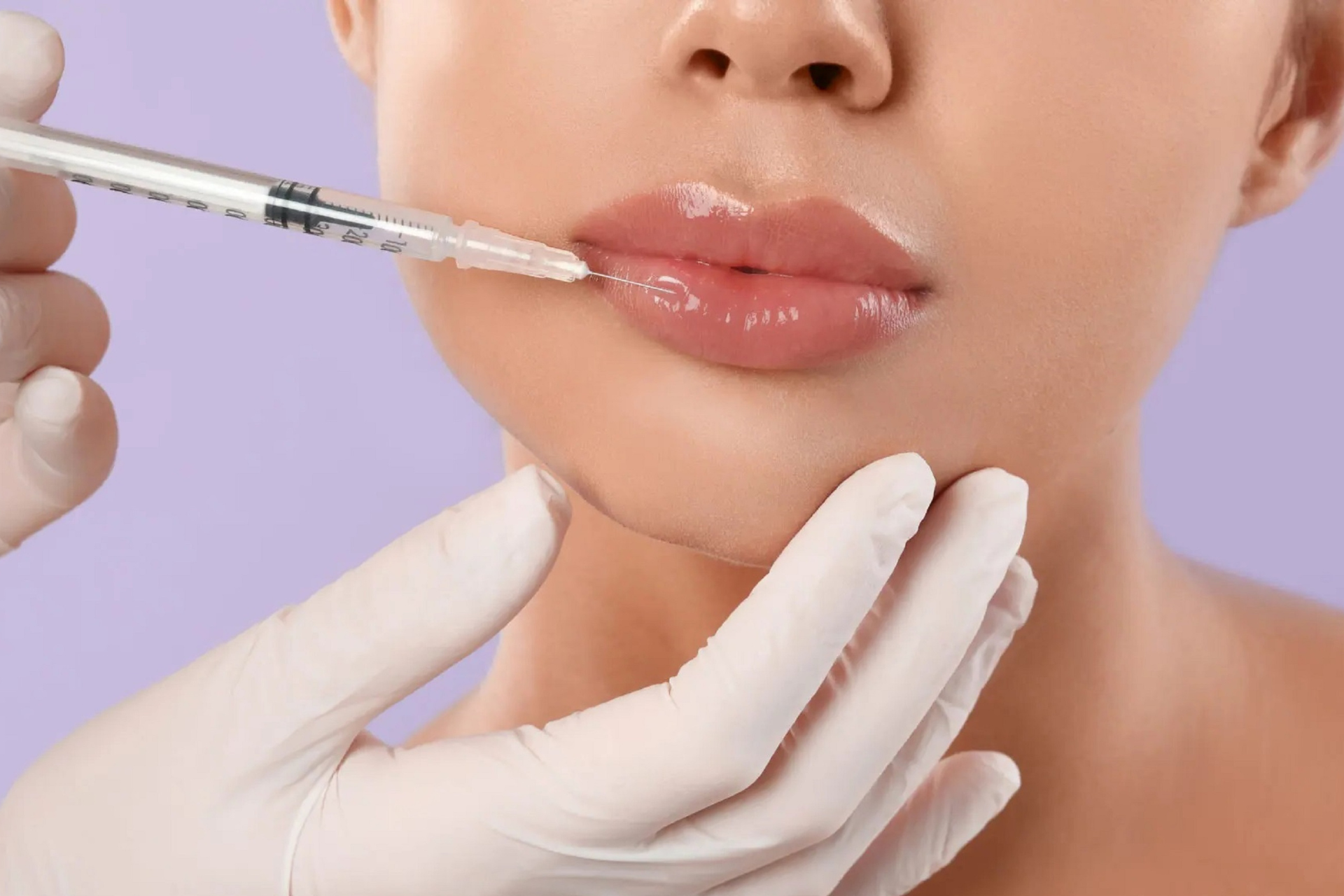 Natural lip fillers