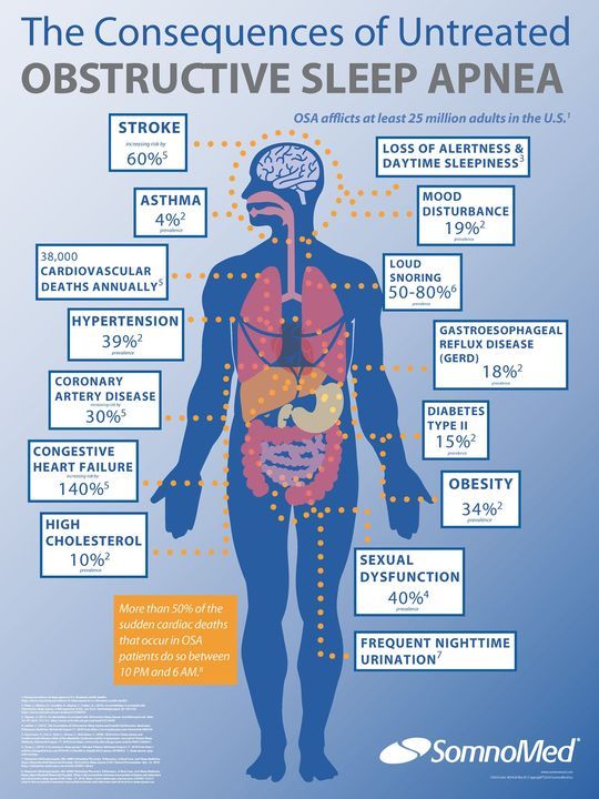 A poster showing the consequences of untreated obstructive sleep apnea