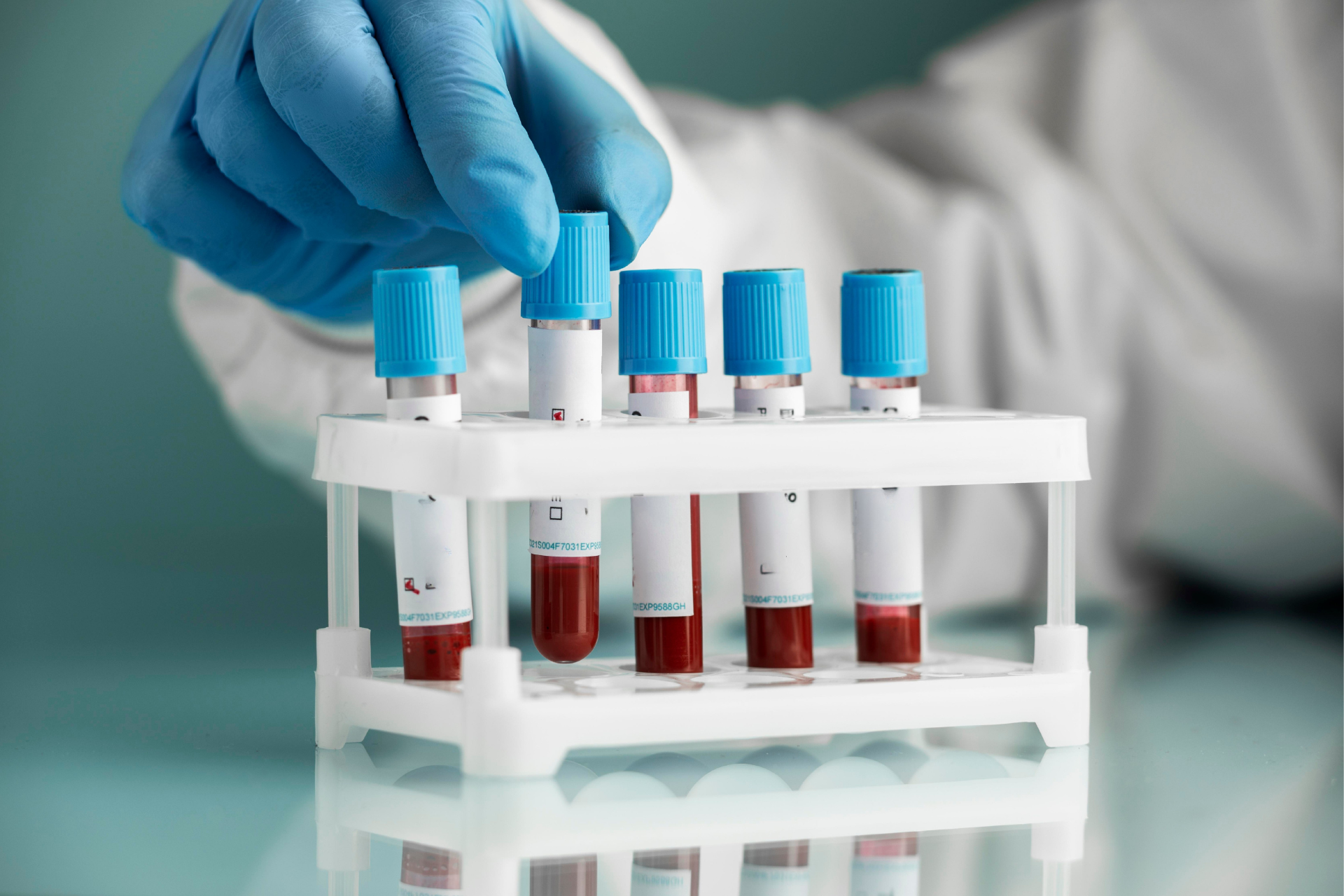 Gloved hand placing blood sample tubes in a lab rack