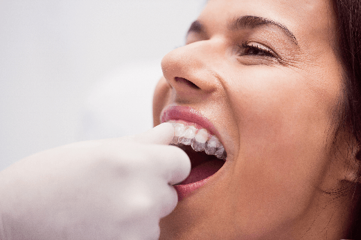 Dentista Especialista Clareamento