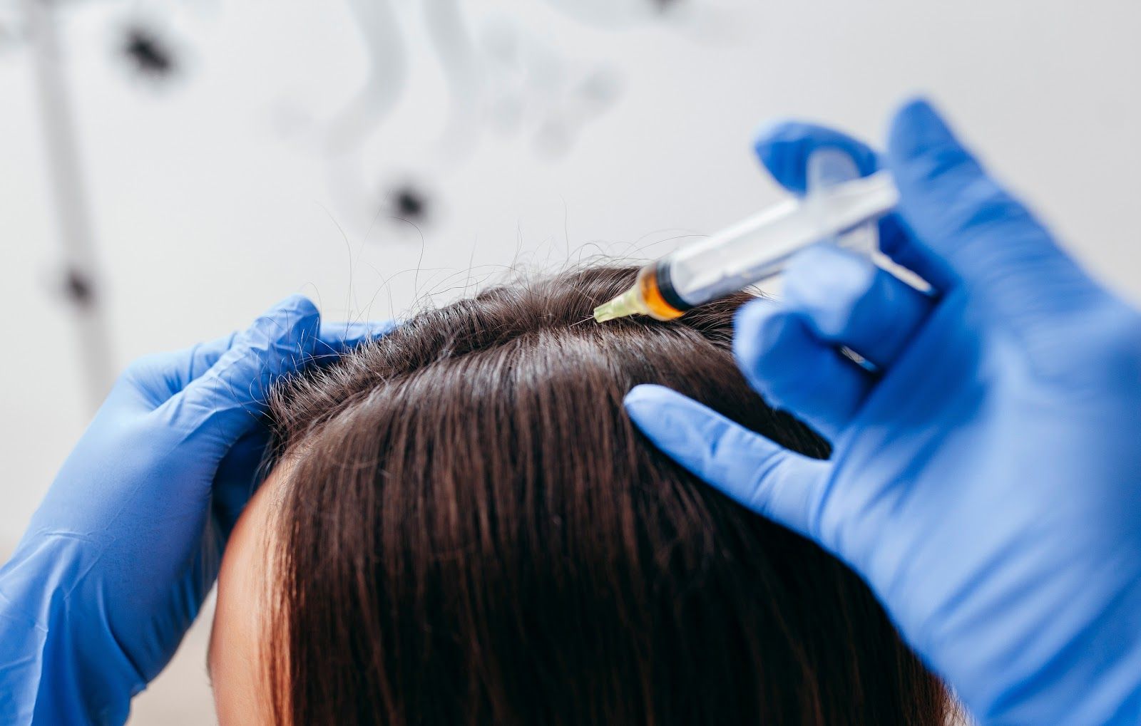Gloved hands using a syringe to inject a dark-haired scalp in a clinical setting