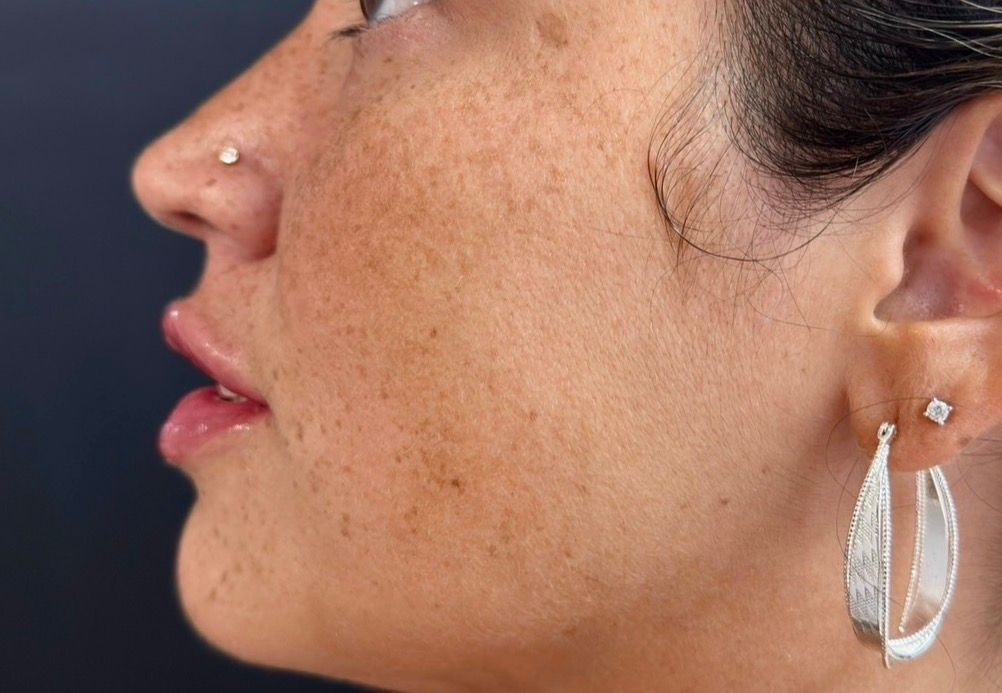 Side profile of a person wearing a nose stud and clear teardrop earring.