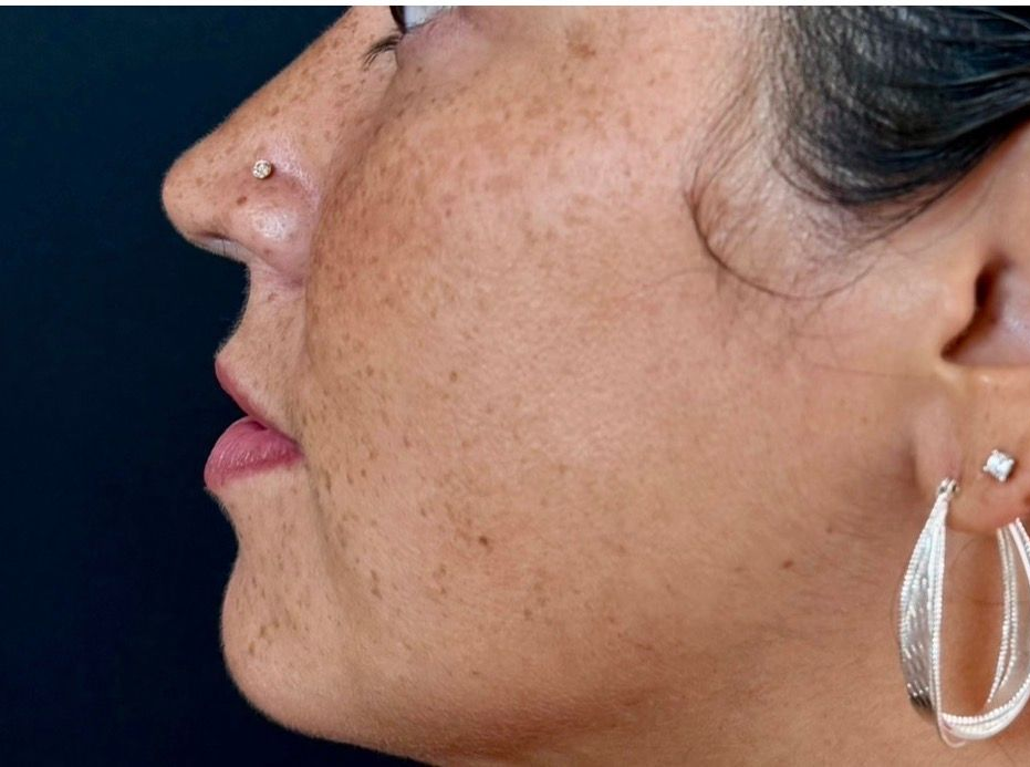 Side profile of a woman wearing a large clear hoop earring and a small stud nose piercing