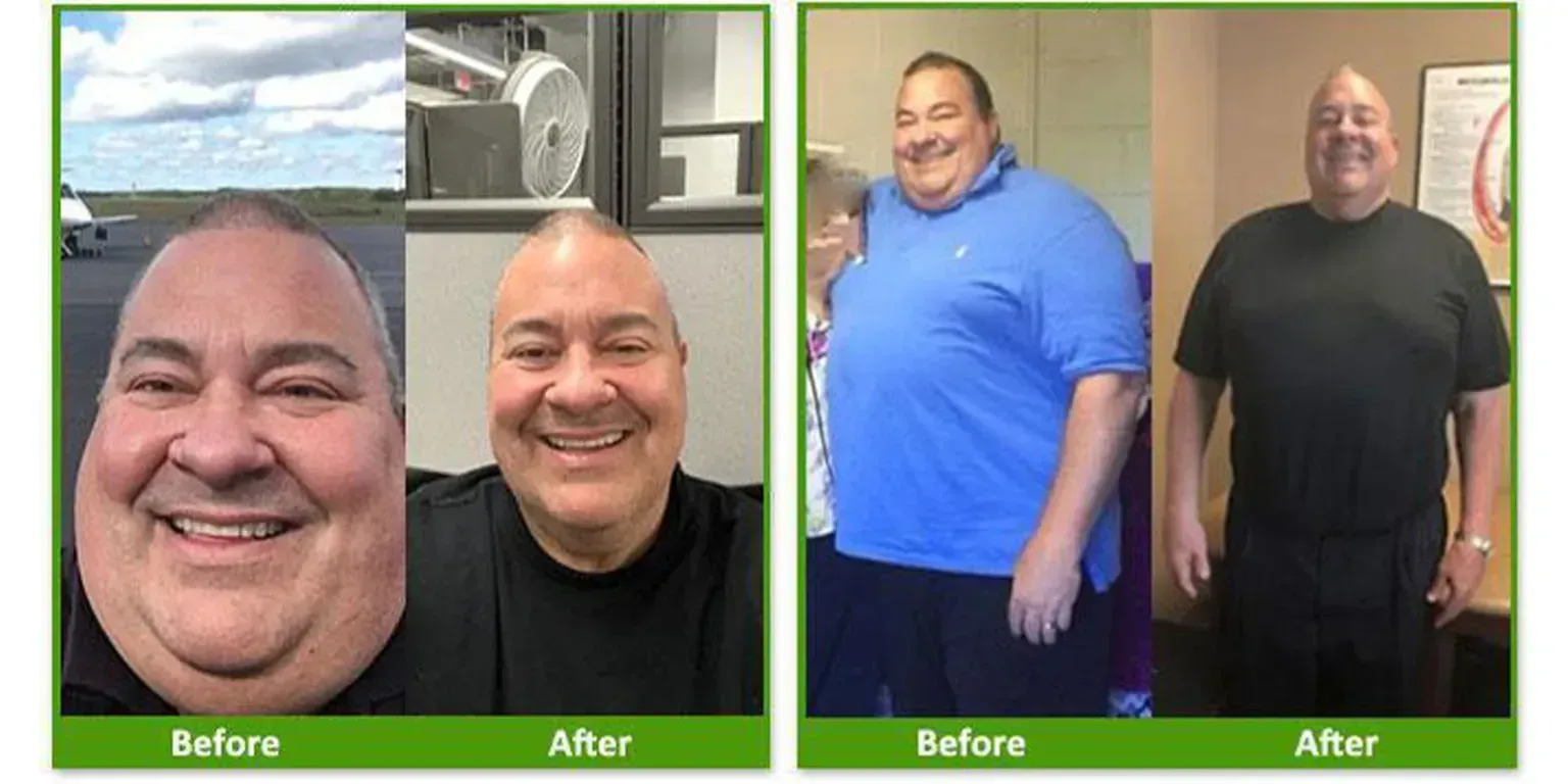 Nova Physician Wellness Center patient transformation weight loss