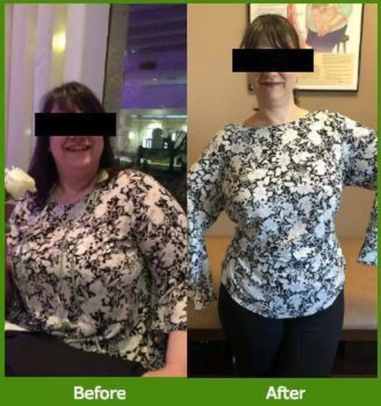 Nova Physician Wellness Center patient transformation weight loss