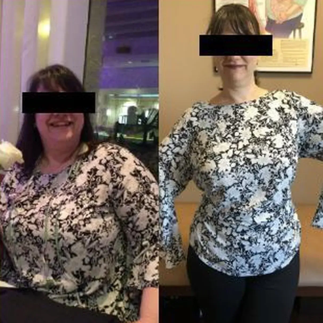 Before and after weight loss transformation photo showing a patient who lost 44 pounds and gained confidence through the Nova Physician Wellness program.