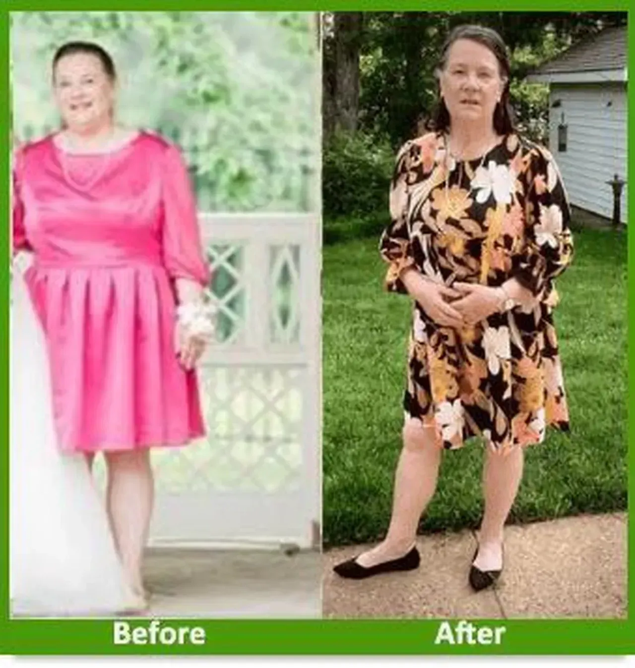 Nova Physician Wellness Center patient transformation weight loss