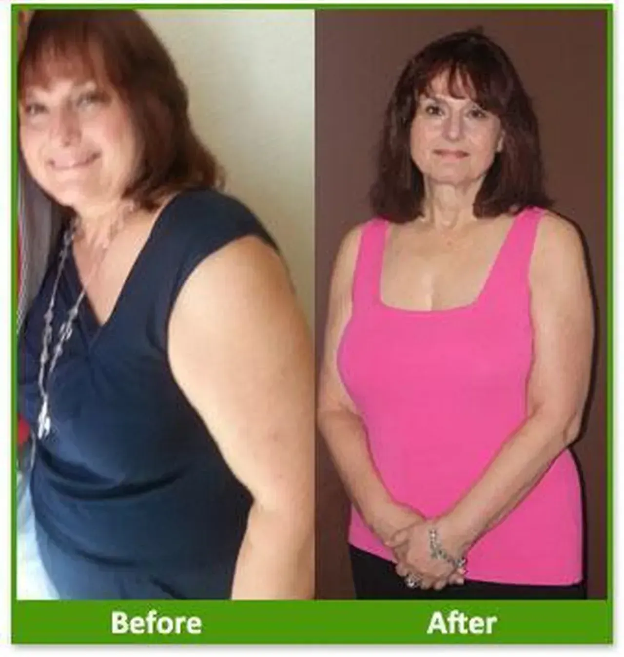 Nova Physician Wellness Center patient transformation weight loss