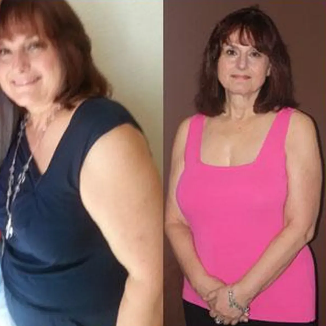 Before and after weight loss transformation photo showing a patient's health and weight loss progress after participating in the Nova Physician Wellness program.