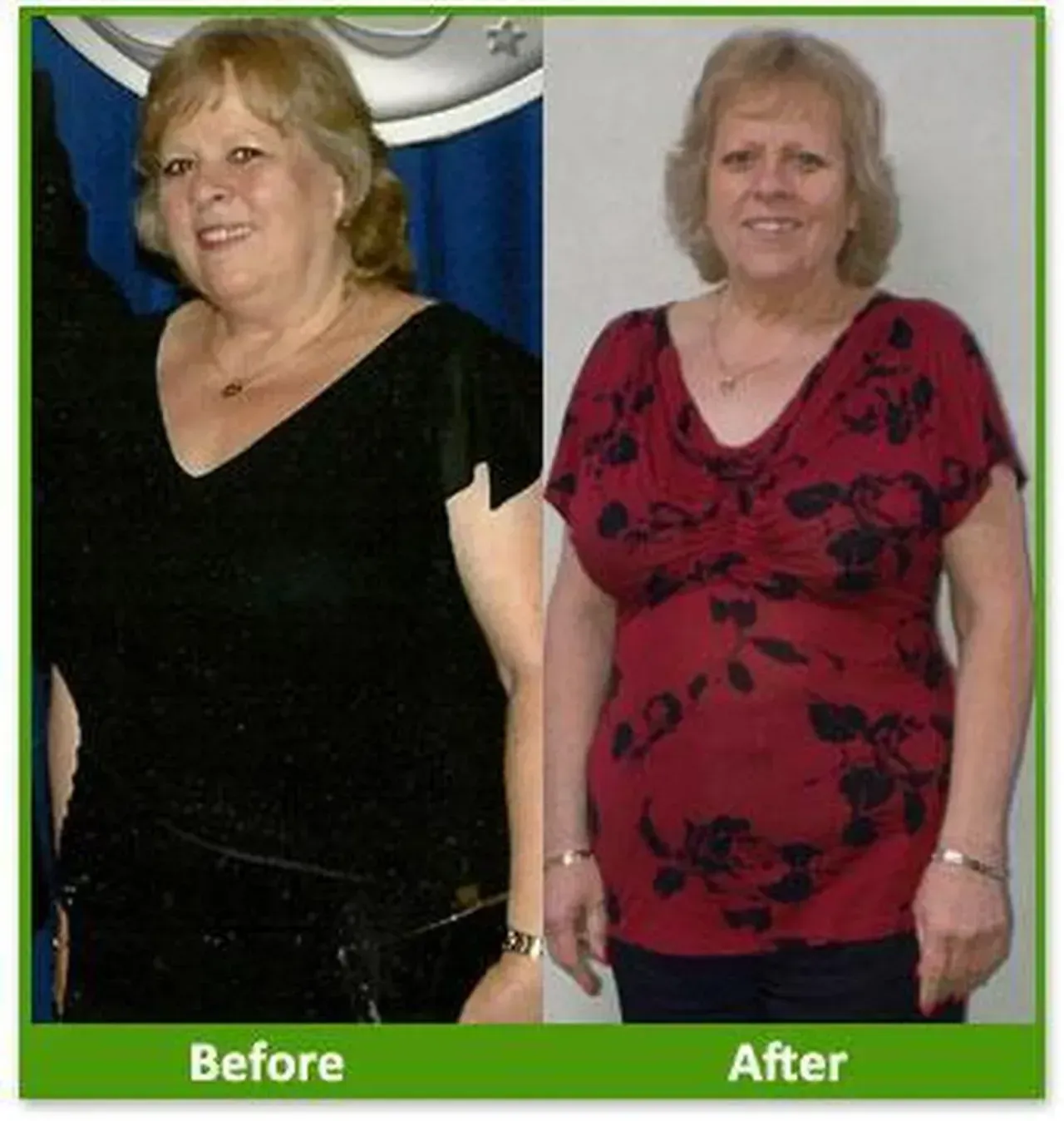 Nova Physician Wellness Center patient transformation weight loss