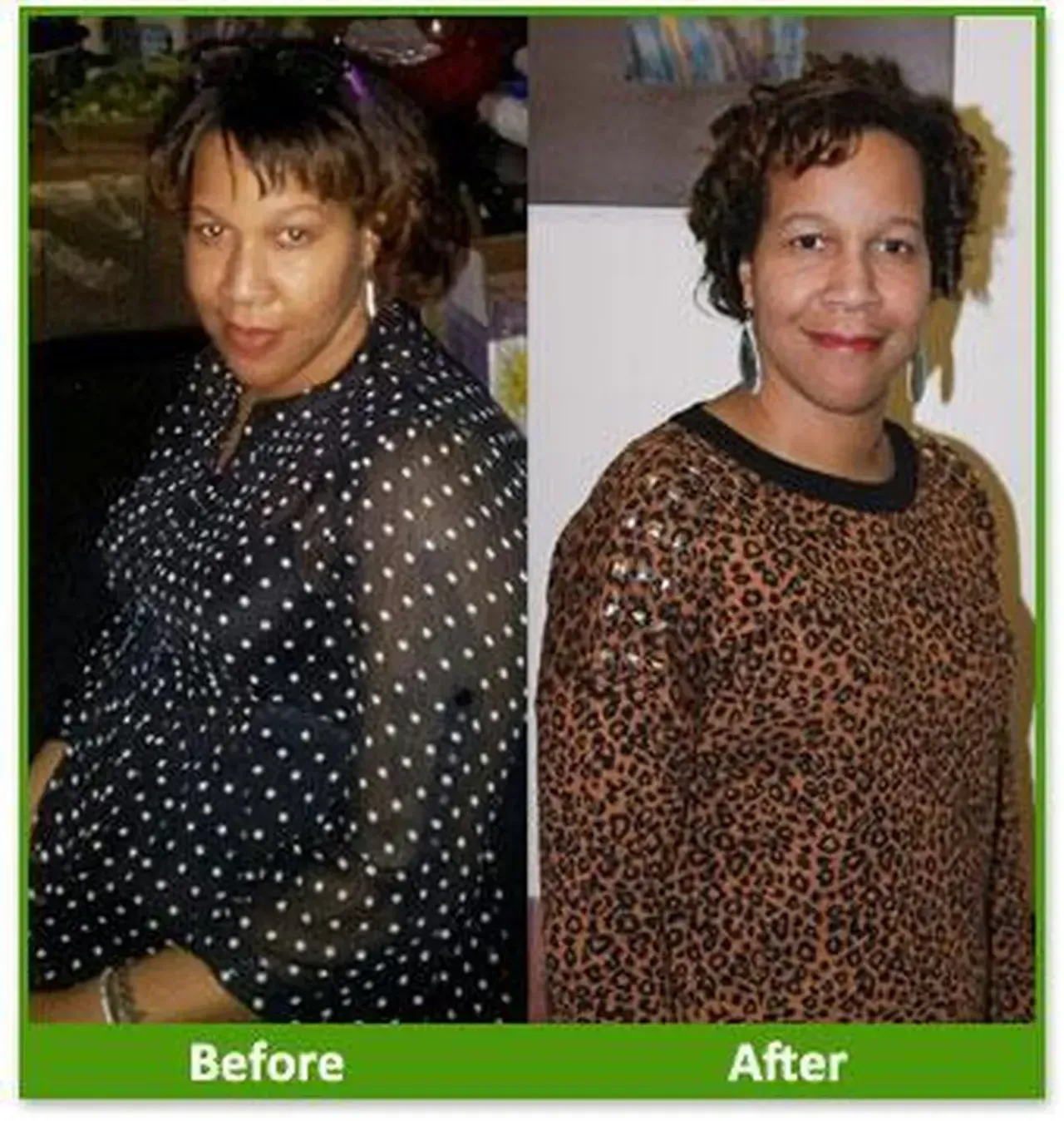 Nova Physician Wellness Center patient transformation weight loss
