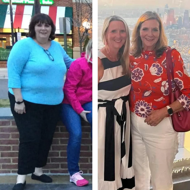 Before and after collage of a woman in casual clothes, with a weight loss transformation of 60 lbs through the Nova Physician Wellness program.