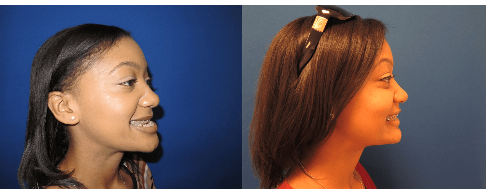 Safe Oral Cosmetics Surgery in D.C. D.C. Surgical Arts