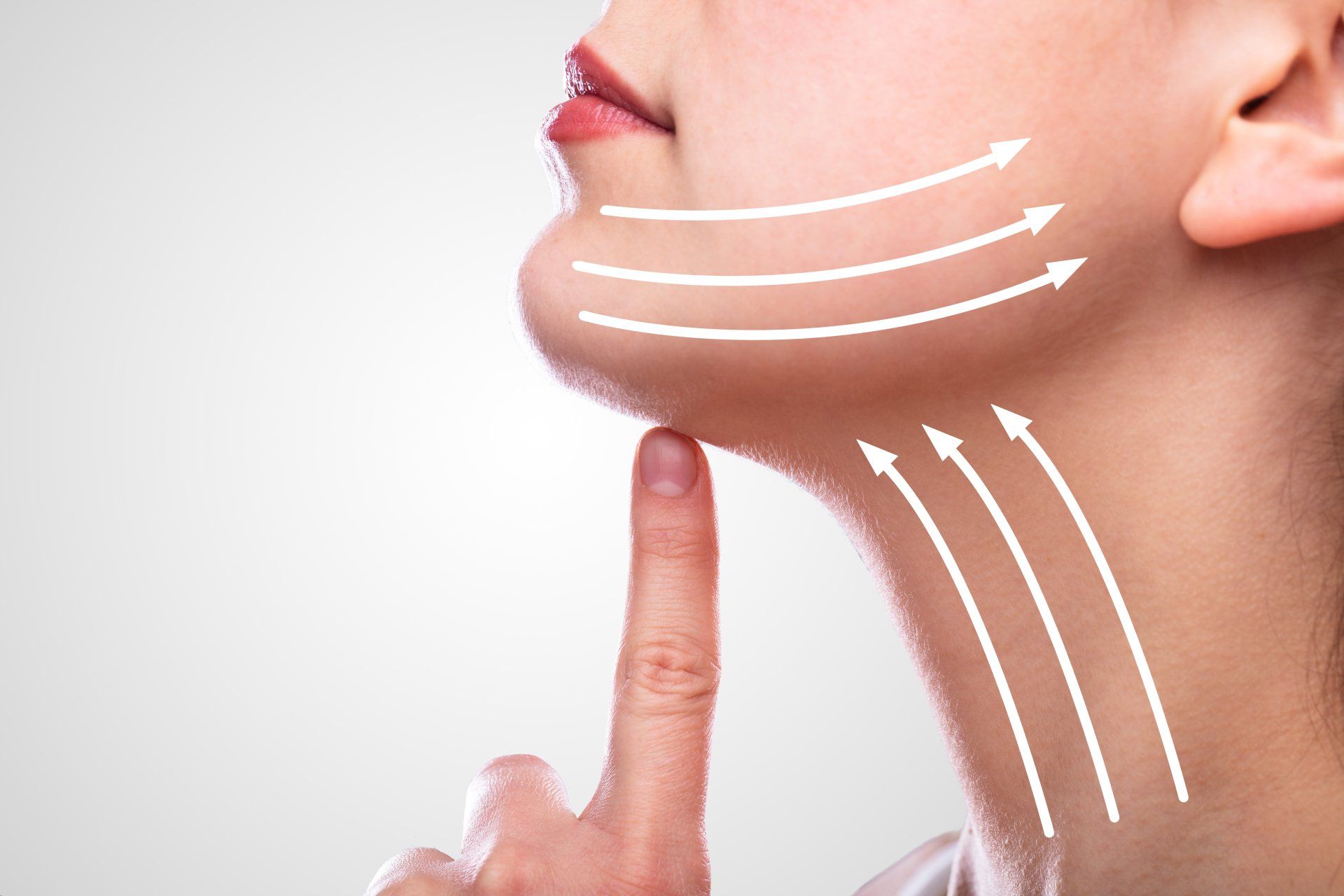 neck lift