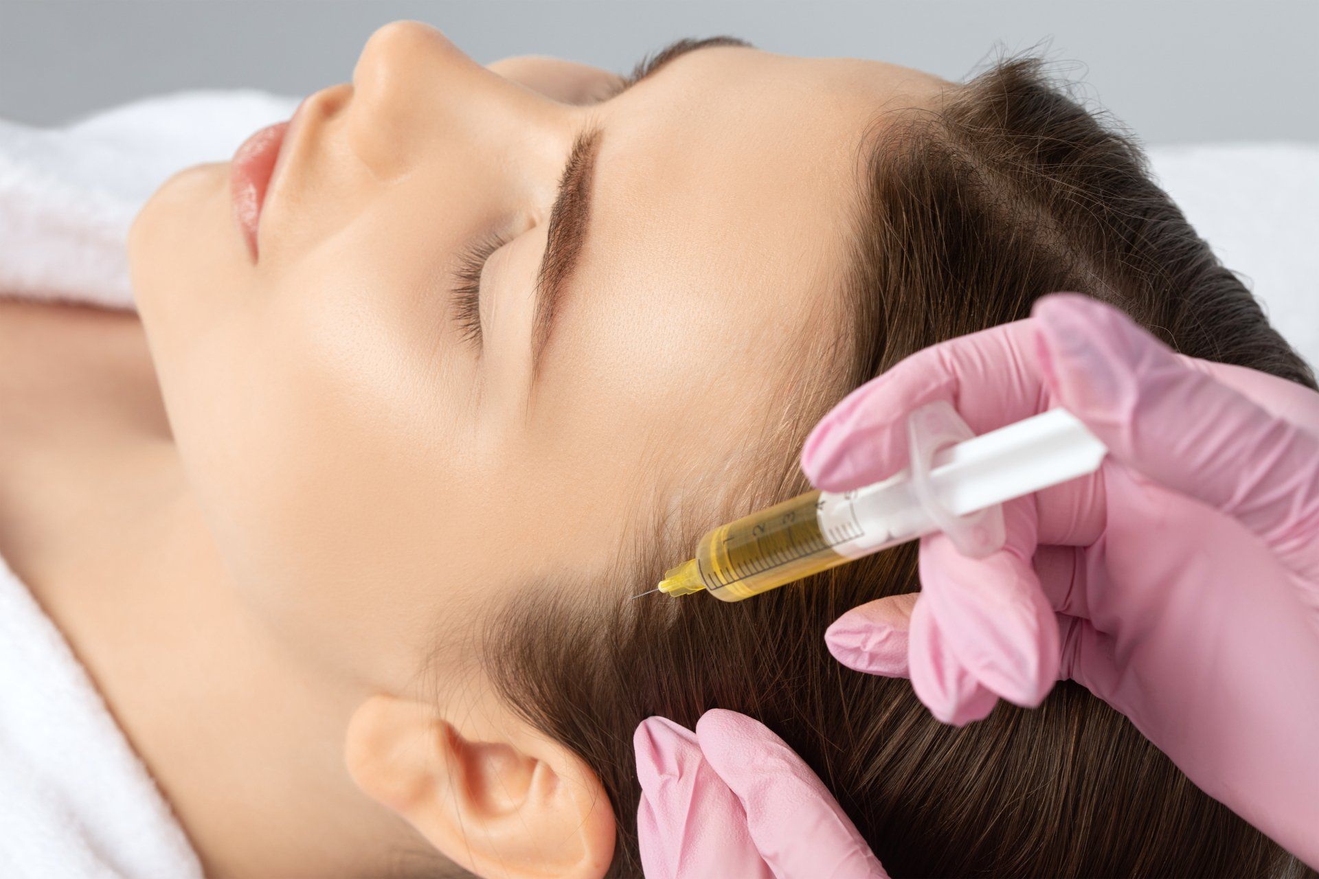 prp hair restoration