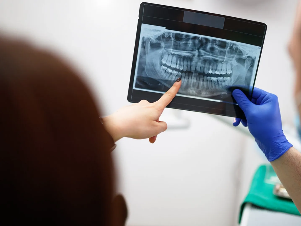 bone grafting