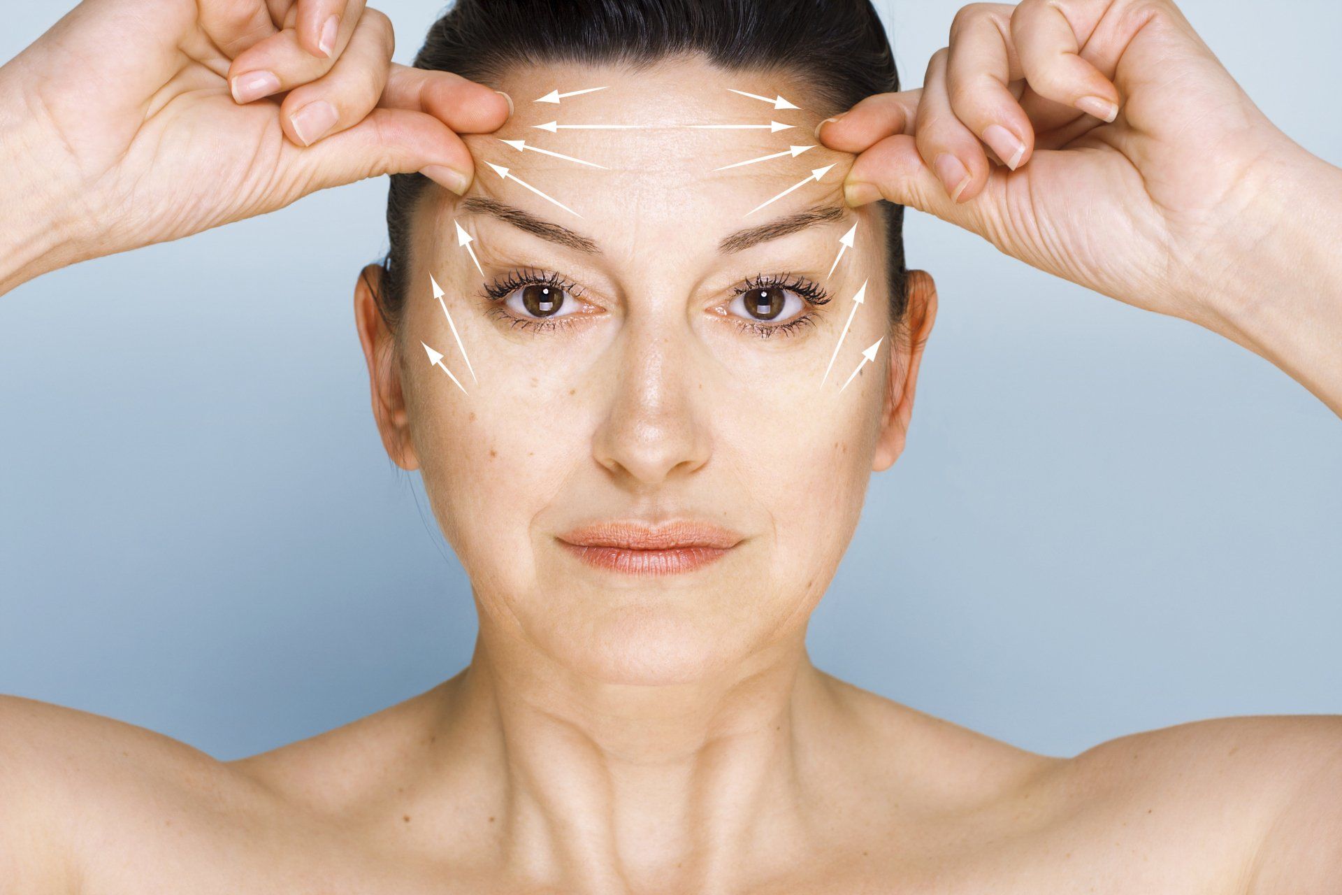 brow and forehead lift