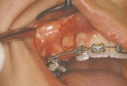 oral cosmetic surgery