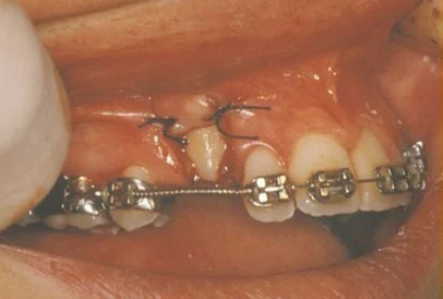 oral cosmetic surgery