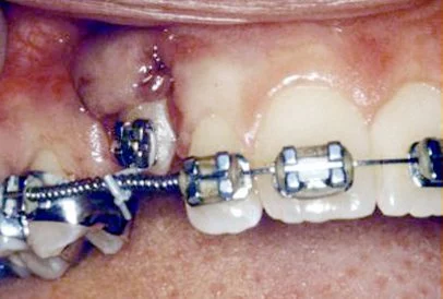 oral cosmetic surgery