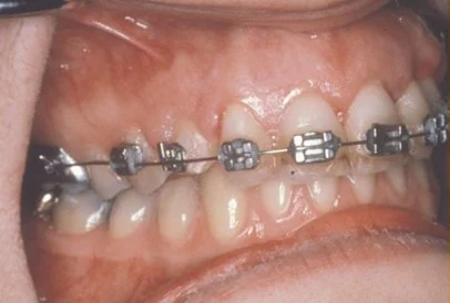 oral cosmetic surgery
