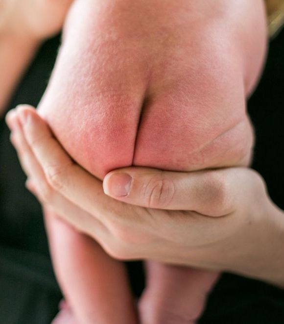 NEOLO, érythème fessier, rouge, fesses bébé douloureuses, soin intime, huile intime