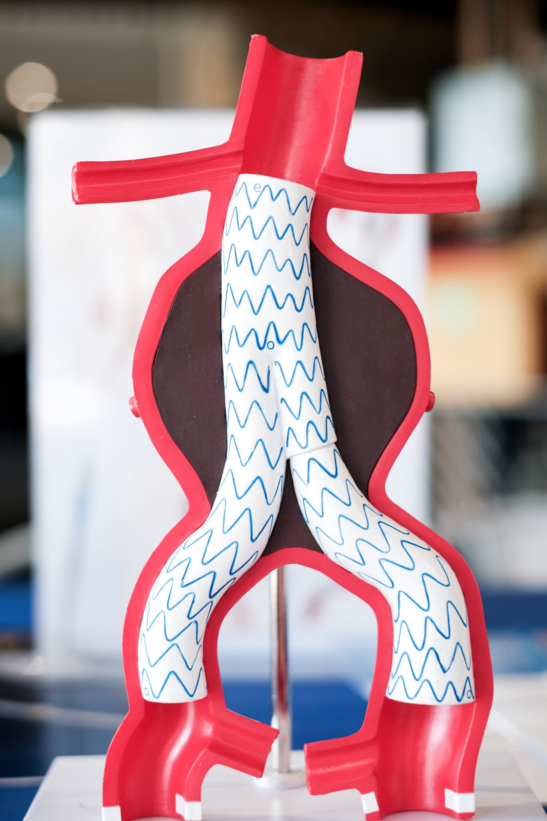 a model of a blood vessel with blue and white lines on it