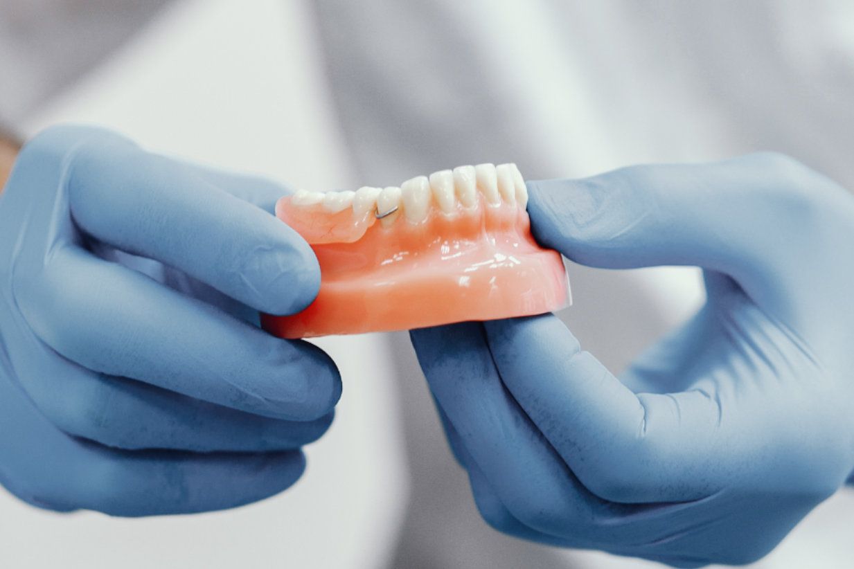 Manos enguantadas sosteniendo una prótesis dental rosa con dientes blancos que se están ajustando.