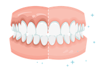 Ilustración de una dentadura postiza sonriente con encías rosadas y dientes blancos, vista frontal.