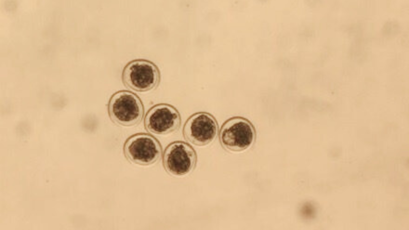 AAA Global Genetics