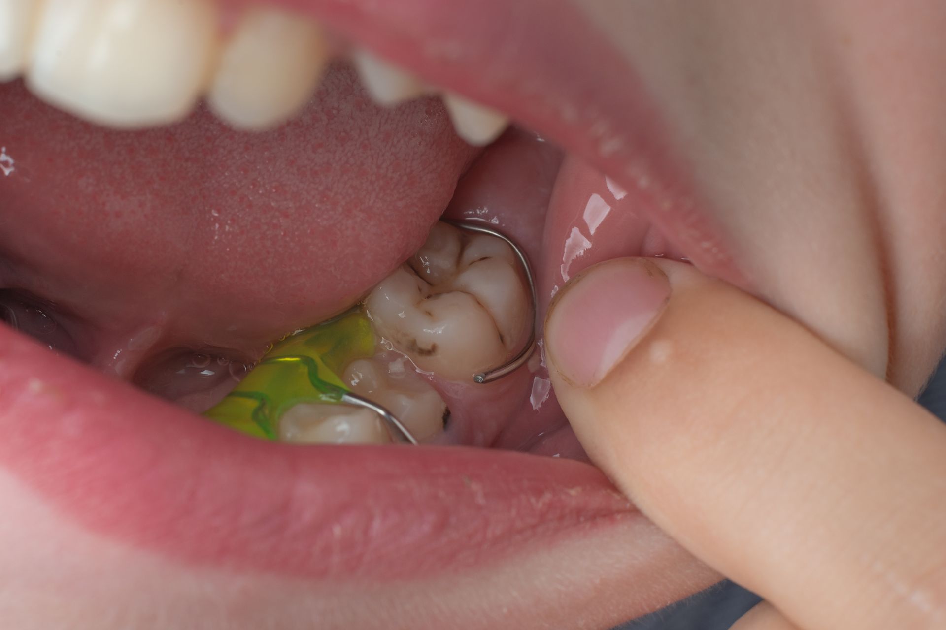 A person is holding a green object in their mouth.