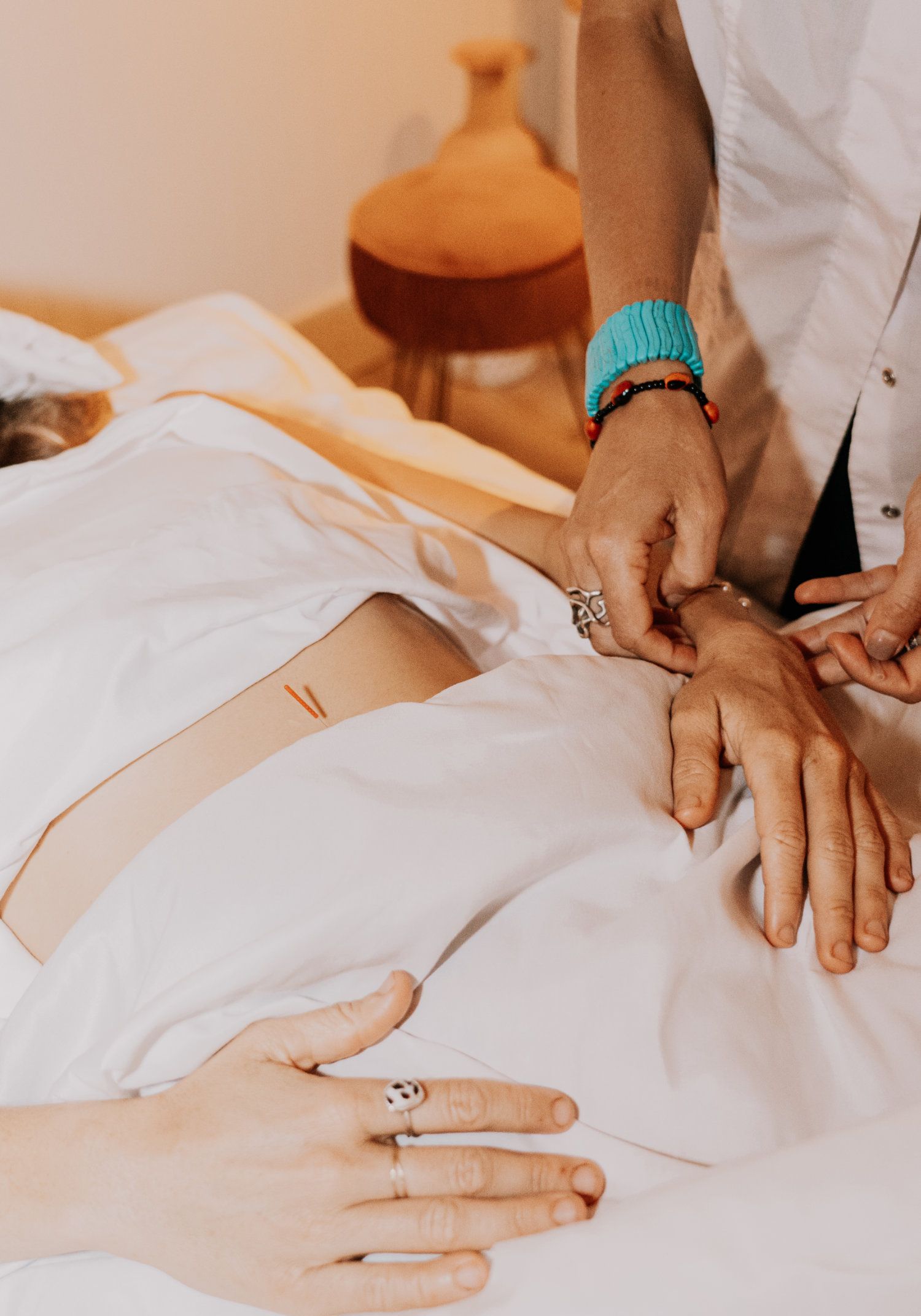 Community Acupuncture