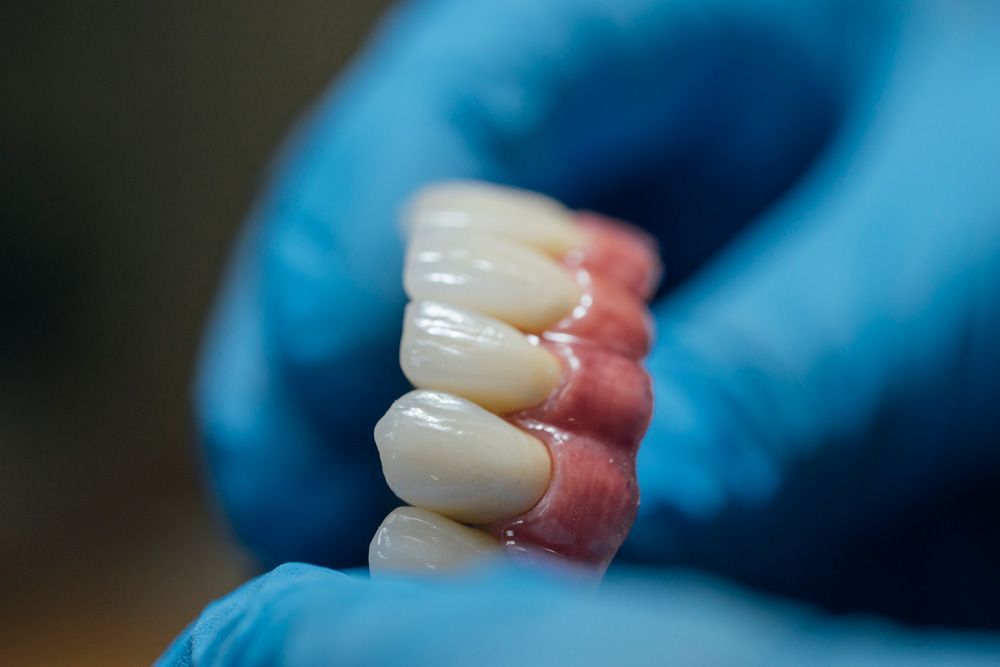 Close-up on Finished Denture Repair — Central Coast, NSW — Peninsula Denture Centre