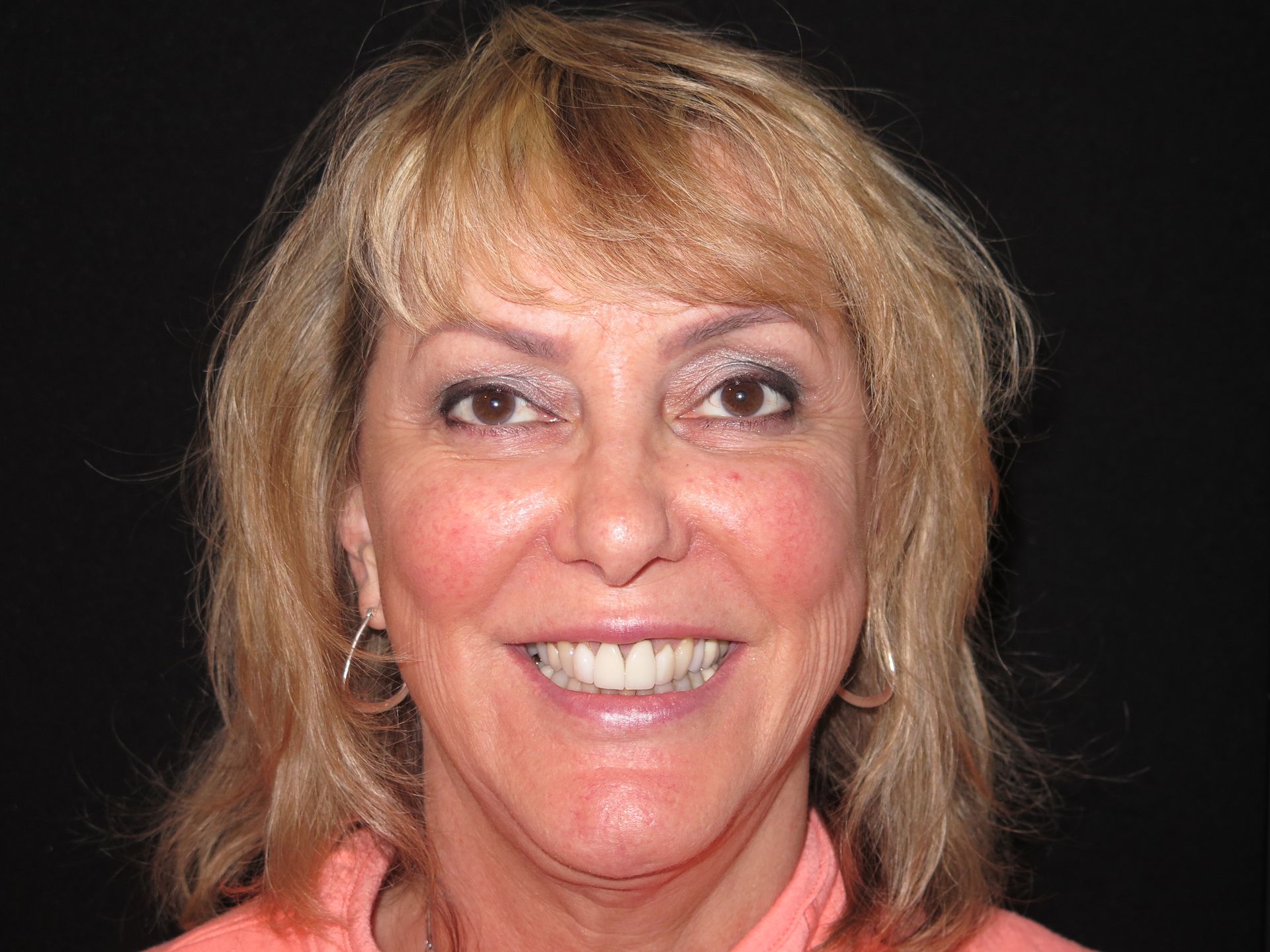 Heather smiling | Patient of dentures in Lynnwood Wa