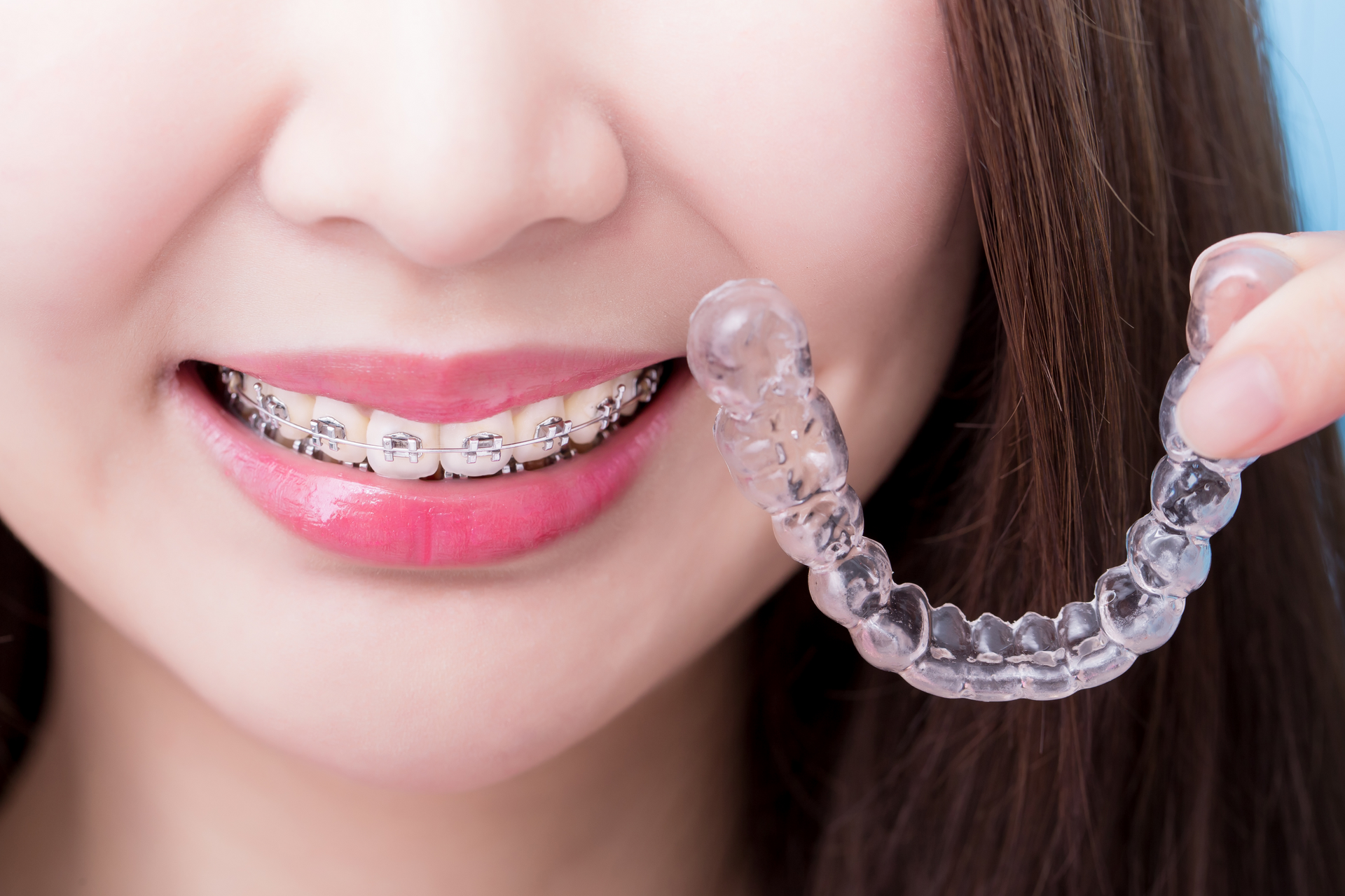 woman smiling with braces holding invisalign clear aligners | dentist in Lynnwood WA
