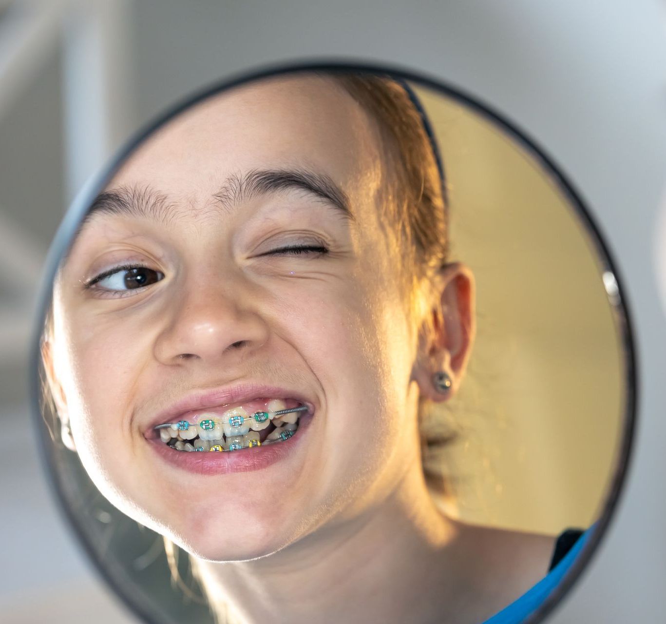 child smiling with braces on | Pediatric dentist lynnwood WA 98036