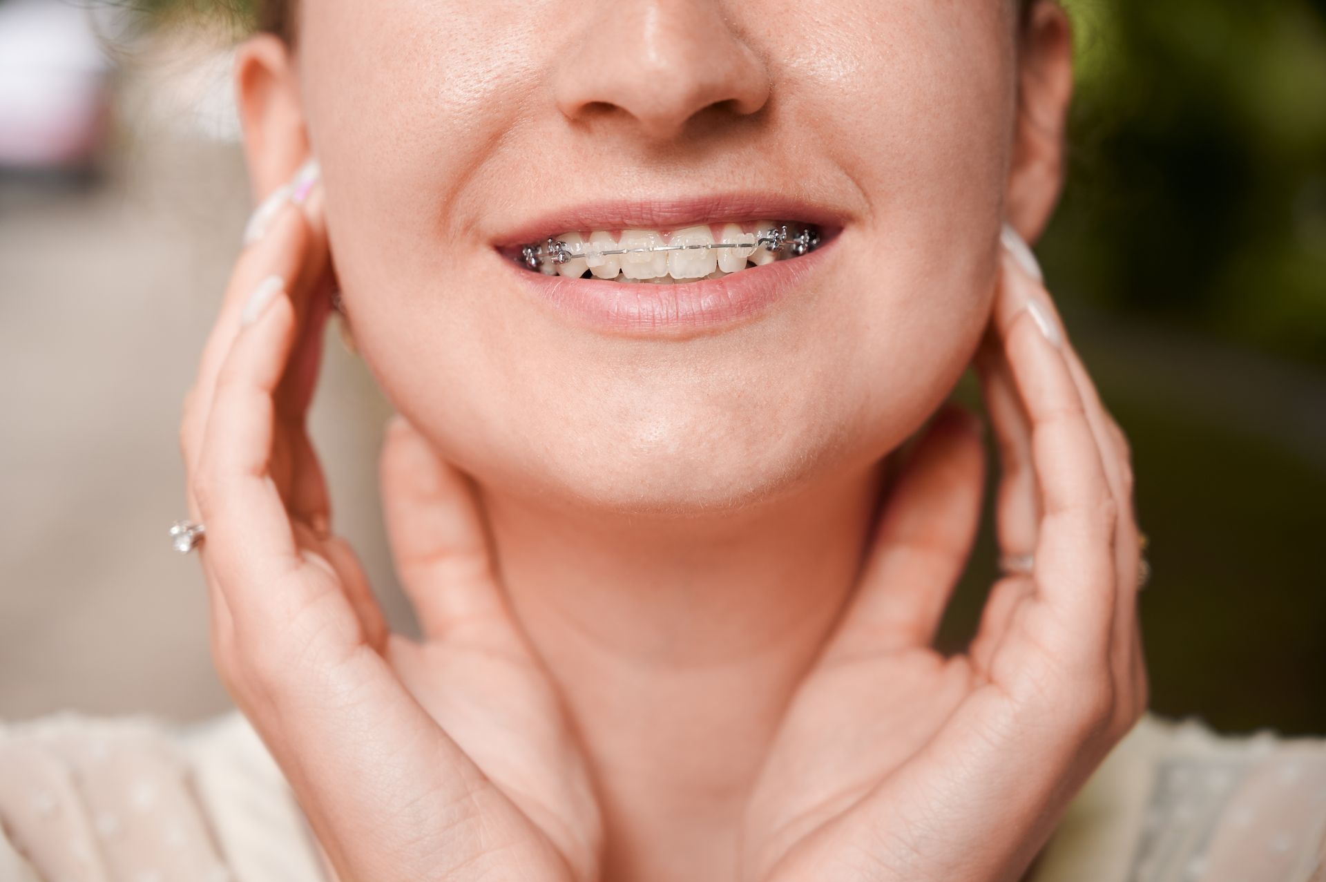 woman smiling with retainer in mouth | Six month smile | Lynnwood WA