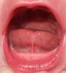 Un primer plano de la boca de un bebé con la lengua fuera.