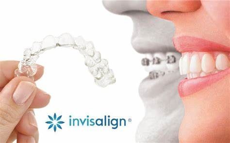 Brackets Invisibles para Adulto