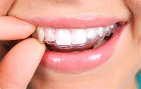 Brackets invisibles invisaling