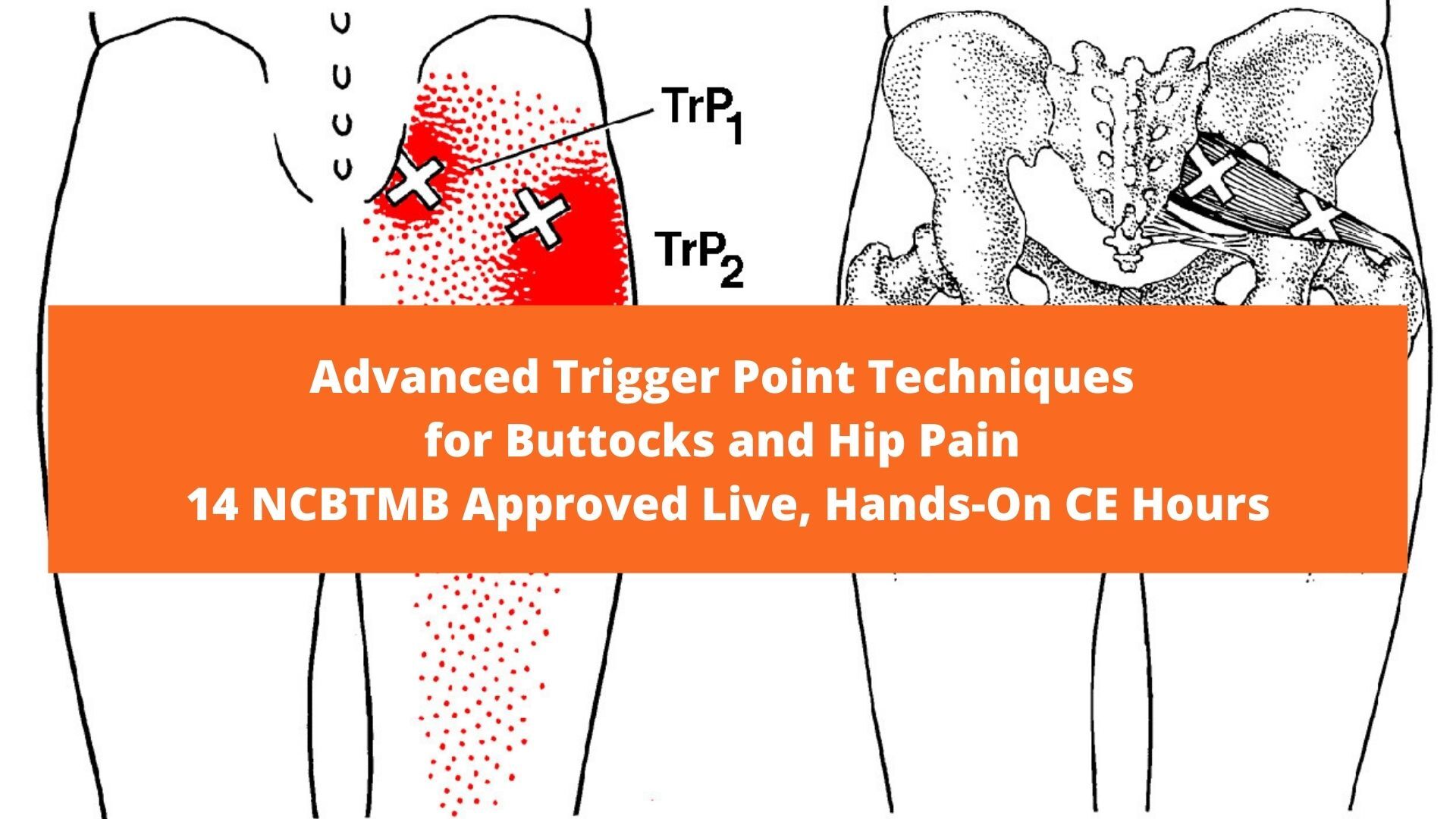 Chicago Center for Myofascial Pain Relief