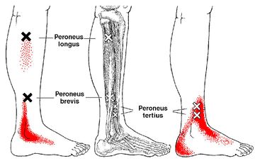 A black and white drawing of a person 's legs and feet with red spots on them.