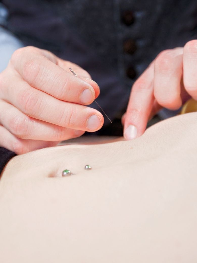 Acupuncture for Stomach
