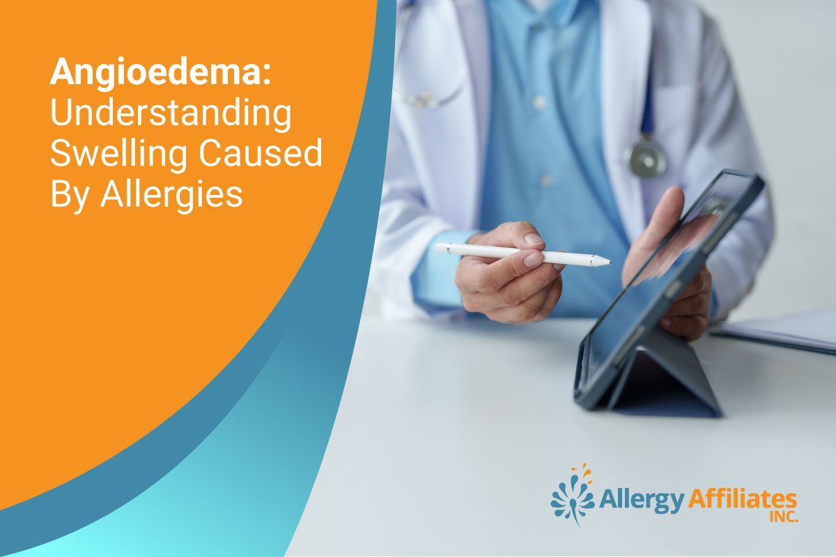 Angioedema: Understanding Swelling Caused By Allergies