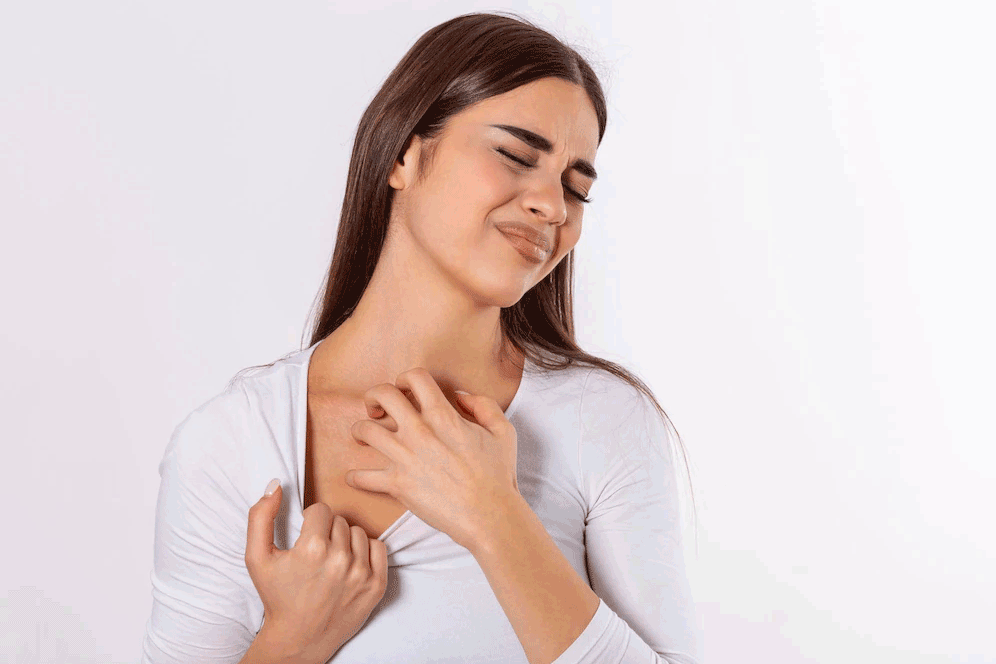 contact dermatitis